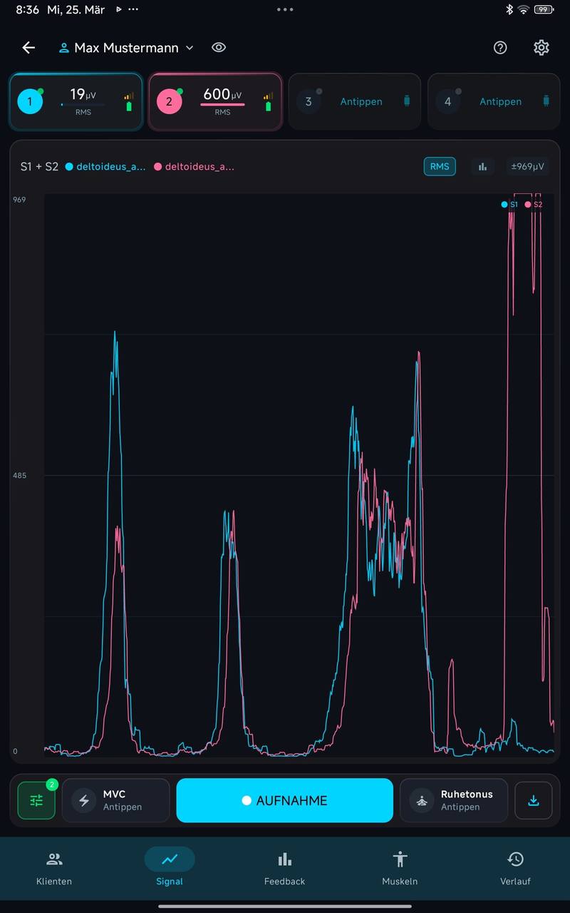 RMS-Daten in Echtzeit